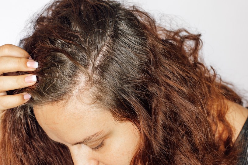 O stanie włosów mogą decydować zaskakujące czynniki /123RF/PICSEL