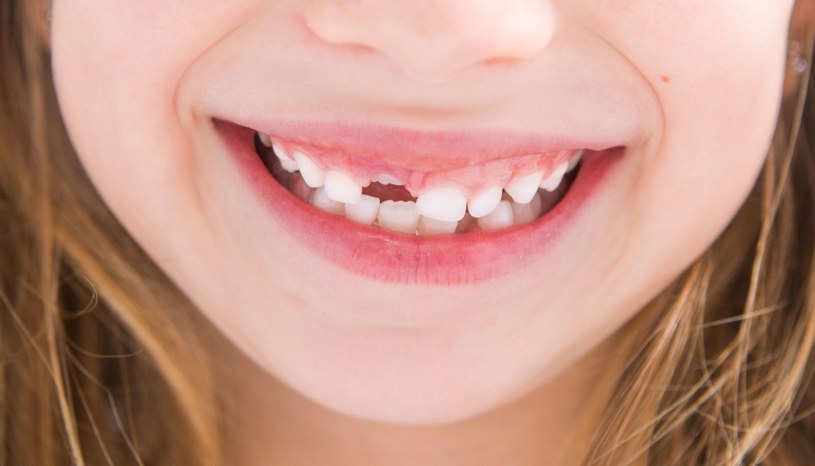 O zdrowe zęby trzeba dbać od najwcześniejszych lat /123RF/PICSEL