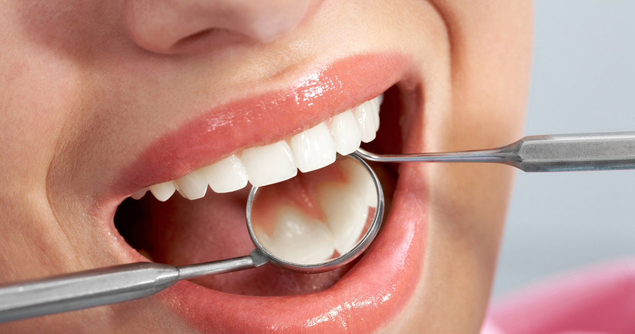 O zęby trzeba dbać, a nie zwalać winę na geny /© Glowimages