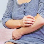 Objaw problemów z nerkami, wątrobą i tarczycą. Zazwyczaj kojarzy się z chorobami skóry