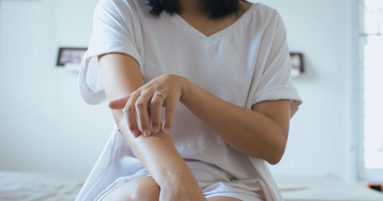 Objawem łuszczycy jest czerwona, bardzo sucha skóra. Chorobę nasila stres i brak witaminy D /123RF/PICSEL