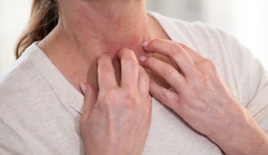 Objawy niedoboru witaminy D zobaczysz na skórze