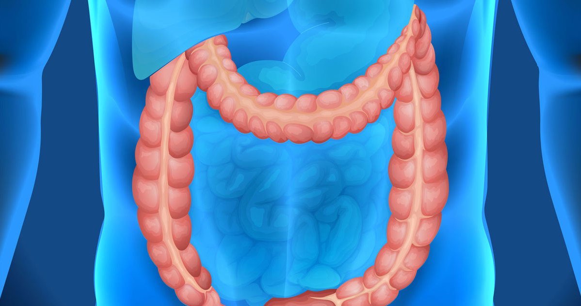 Objawy raka jelita grubego różnią się w zależności od tego, gdzie umiejscowione są zmiany chorobowe /123RF/PICSEL