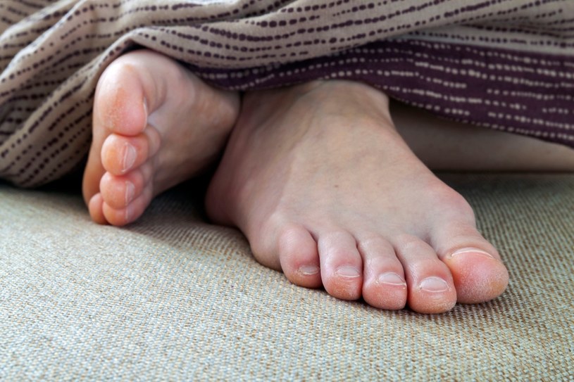 Obolałe lub spuchnięte stopy mogą świadczyć o wielu schorzeniach /123RF/PICSEL