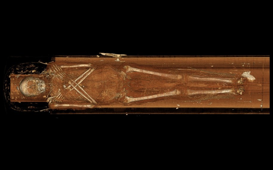 Obraz 3D ciała Nes-Mina /Fot. Keck Medicine of USC /Materiały prasowe