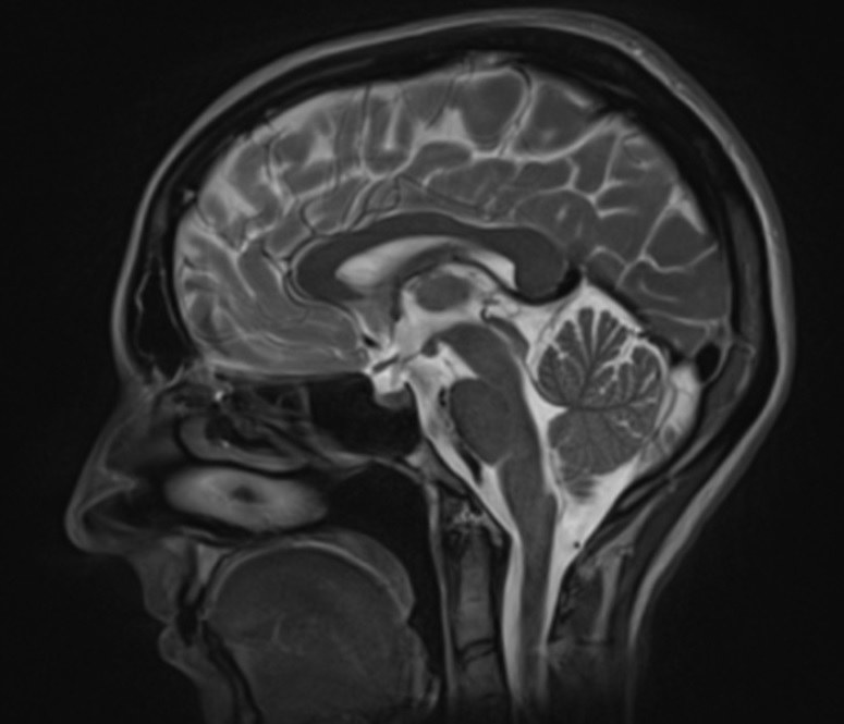 Obraz głowy otrzymany w badaniu z pomocą rezonansu magnetycznego /Krakowski Szpital Specjalistyczny im. Jana Pawła II /