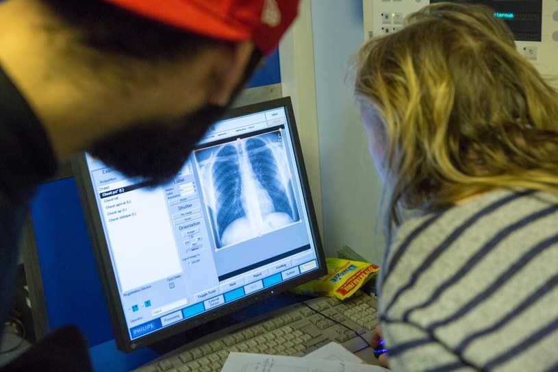 Obraz klatki piersiowej uzyskiwany podczas badania tomograficznego, powstaje dzięki promieniowaniu rentgenowskiemu /Getty Images