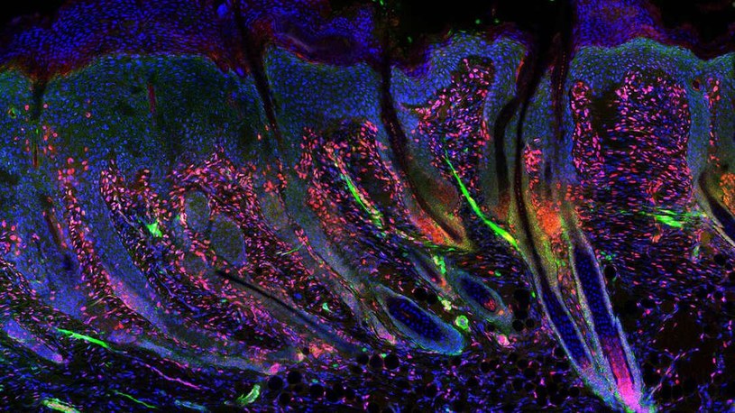Obraz mikroskopowy regenerujących się komórek skóry /materiały prasowe