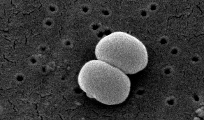 Obraz S. epidermidis w mikroskopie elektronowym skaningowym /Wikipedia