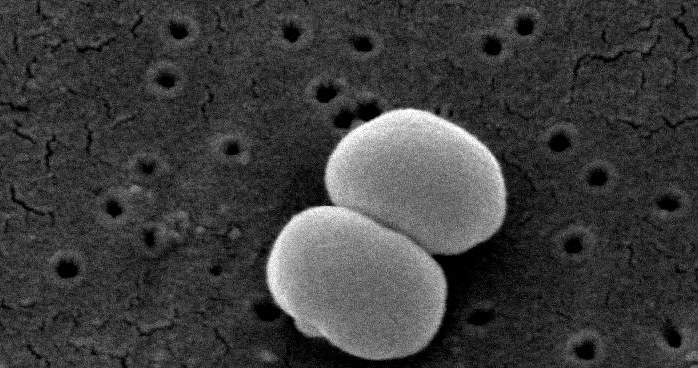 Obraz S. epidermidis w mikroskopie elektronowym skaningowym /Wikipedia