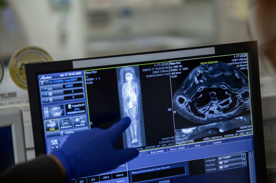 Obraz tomograficzny mumii Nes-Hora /Fot. Ricardo Carrasco III /Materiały prasowe