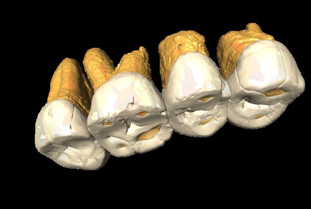 Obraz tomograficzny znalezionych zębów Homo luzonenzis /Callao Cave Research Project /Materiały prasowe