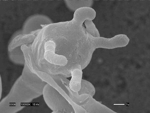 Obraz zarodnika szczepu VGIIc C. gattii, otrzymany przy pomocy mikroskopu elektronowego &nbsp; /Edmond Byrnes III i Joseph Heitman, Duke Dept. of Molecular Genetics and Microbiology