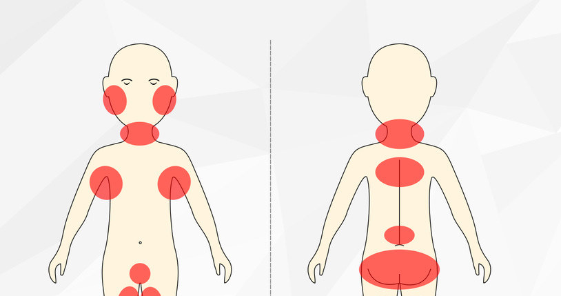 Obrażenia w tych miejscach rzadko powstają w przypadkowy sposób /INTERIA.PL