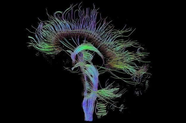 Obrazowanie tensora dyfuzji ujawnia wiele szczegółów mózgu /materiały prasowe