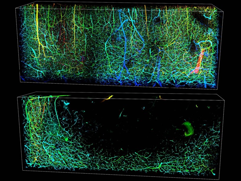 Obrazy 3D naczyń krwionośnych mózgu myszy przedstawiają stan normalny (góra) i po udarze niedokrwiennym (dół), który występuje, gdy zakrzep w naczyniu krwionośnym blokuje przepływ krwi w mózgu /materiały prasowe