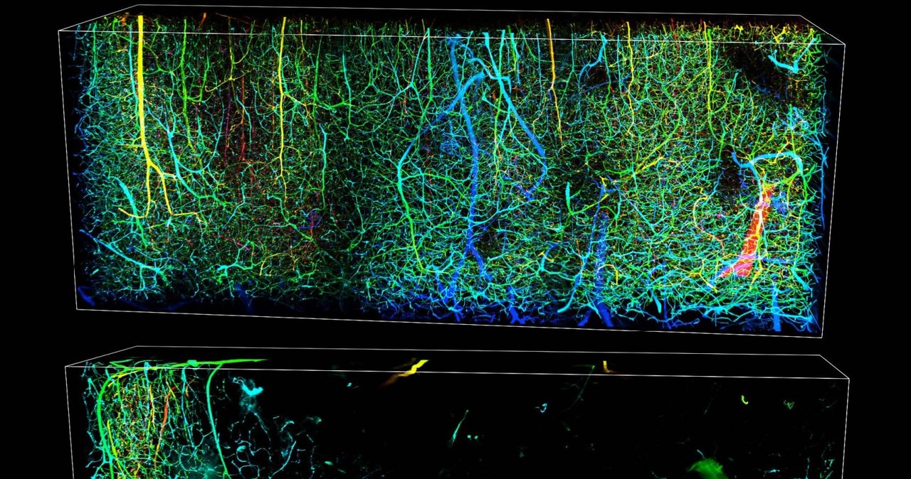 Obrazy 3D naczyń krwionośnych mózgu myszy przedstawiają stan normalny (góra) i po udarze niedokrwiennym (dół), który występuje, gdy zakrzep w naczyniu krwionośnym blokuje przepływ krwi w mózgu /materiały prasowe
