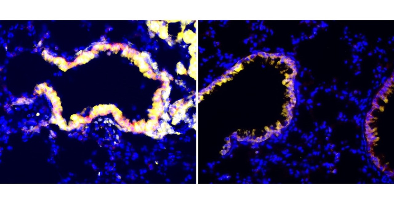 Obrazy immunofluorescencyjne płuc poddanych działaniu promieniowania (po lewej) lub bez promieniowania (po prawej). Oskrzelikowe komórki maczugowate wydzielają więcej czynników antyimmunosupresyjnych po napromieniowaniu, co widać po wzroście markera CC10 (żółty).