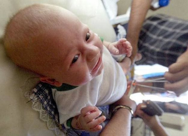 Obrzezanie noworodków jest zabiegiem wykonywanym rutynowo w amerykańskich szpitalach /AFP