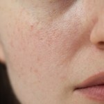 Ochłodzenie na horyzoncie. Jak przygotować naszą skórę?