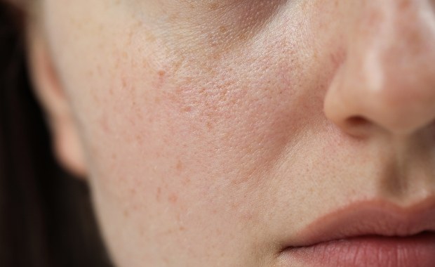 Ochłodzenie na horyzoncie. Jak przygotować naszą skórę?