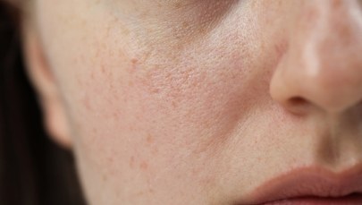 Ochłodzenie na horyzoncie. Jak przygotować naszą skórę?