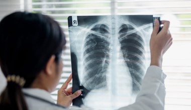 Oddech może pomóc wykryć raka płuca. Naukowcy opracowali nieinwazyjny test
