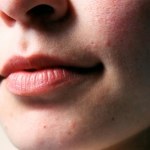 Odkryj naturalny sposób na ochronę ust. Prosty przepis zapewni miękkość i regenerację