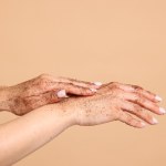Odkryj sekretny sposób na ratunek dla dłoni zimą. Ten apteczny produkt Cię zaskoczy