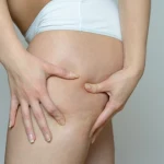 Odkryj sprawdzone domowe triki na cellulit. Pozbądź się pomarańczowej skórki bez wychodzenia z domu