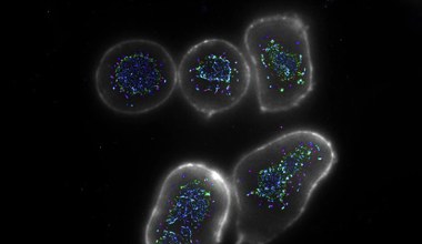 Odkryli sposób na "superdoładowanie" układu odpornościowego do walki z rakiem