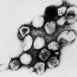 Odkryto dwa nowe wirusy podobne do wirusa różyczki