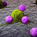 Odkryto gen odpowiedzialny za wyjątkowo agresywnego raka piersi
