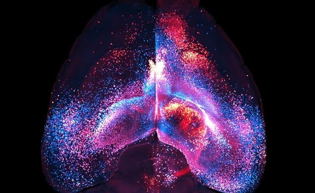 Odkryto kolejną tajemnicę mózgu, nieznaną dotąd sieć połączeń