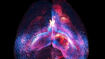 Odkryto kolejną tajemnicę mózgu, nieznaną dotąd sieć połączeń