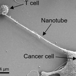 Odkryto nowy mechanizm działania komórek nowotworowych