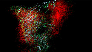 Odkryto nowy typ komórek w sercu