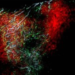 Odkryto nowy typ komórek w sercu