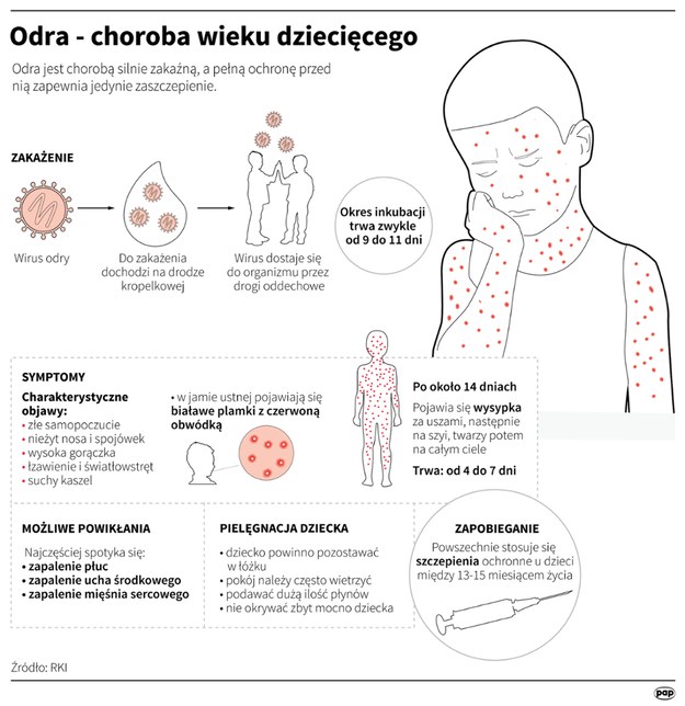 Odra - choroba wieku dziecięcego /Infografika /PAP