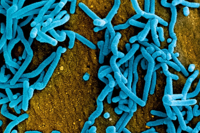 Ognisko śmiertelnego wirusa Marburg wykryto w Gwinei Równikowej. WHO zareagowała /IMAGE POINT FR/NIH/NIAID/BSIP/Universal Images Group via Getty Images /Getty Images