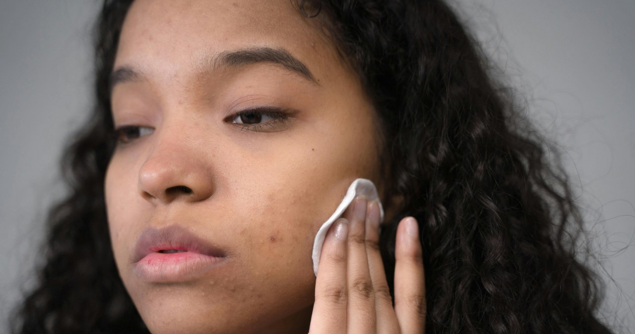 Okład z rumianku skutecznie złagodzi zaczerwienienia i stan zapalny po trądziku /Ron Lach /pexels.com