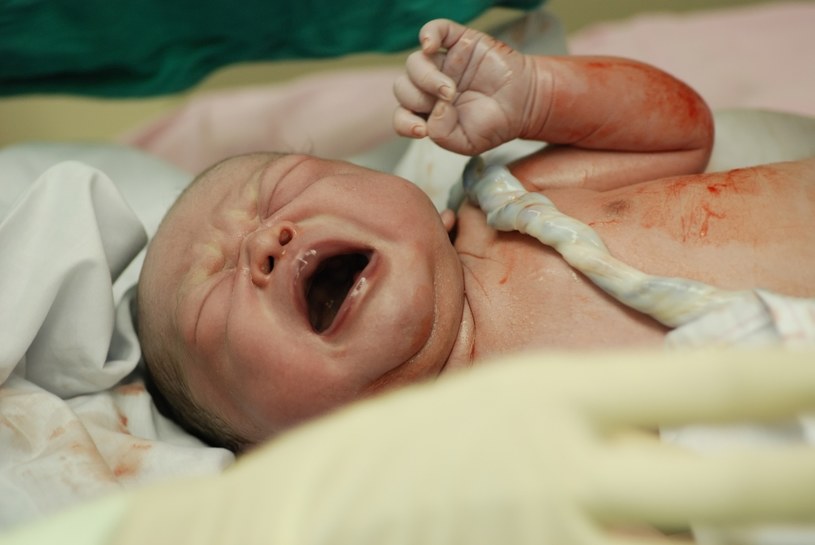 Około 20-30 proc. noworodków przychodzi na świat owiniętych pępowiną /123RF/PICSEL