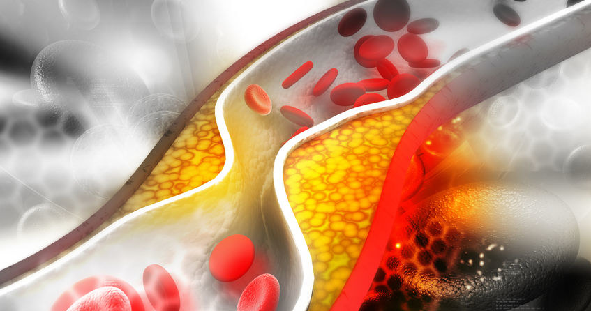 Olej a cholesterol /&copy;123RF/PICSEL