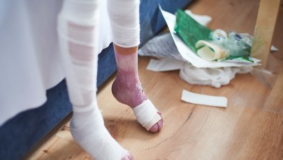 Opatrunki podrożały nawet o ponad 700 procent! Pacjenci: "Nie stać nas na leczenie"