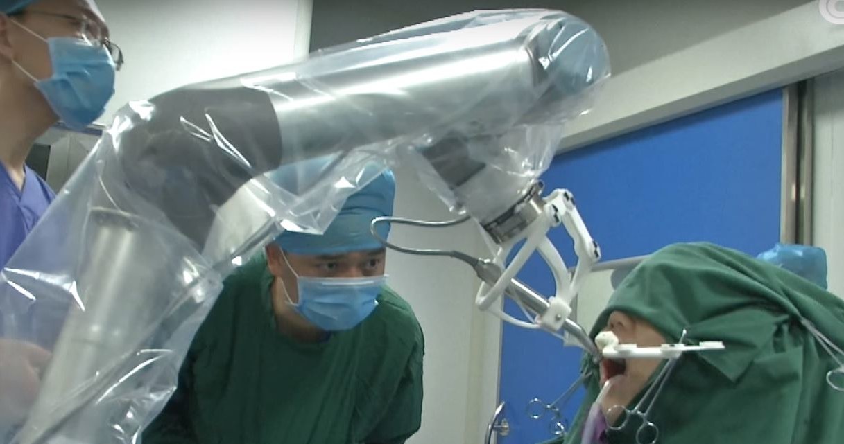 Operacja przeprowadzona przez robota-dentystę przebiegła pomyślnie. Zrzut ekranu z filmiki: World First Autonomous Dental Implant Robot /YouTube