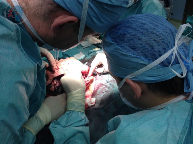 Operacja trwała 23 godziny /Centrum Onkologi w Gliwicach  /PAP