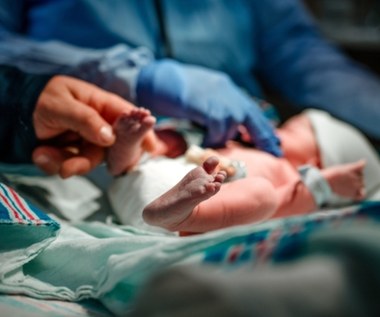 Operacja w 11. minucie życia. Noworodek z guzem wielkości serca