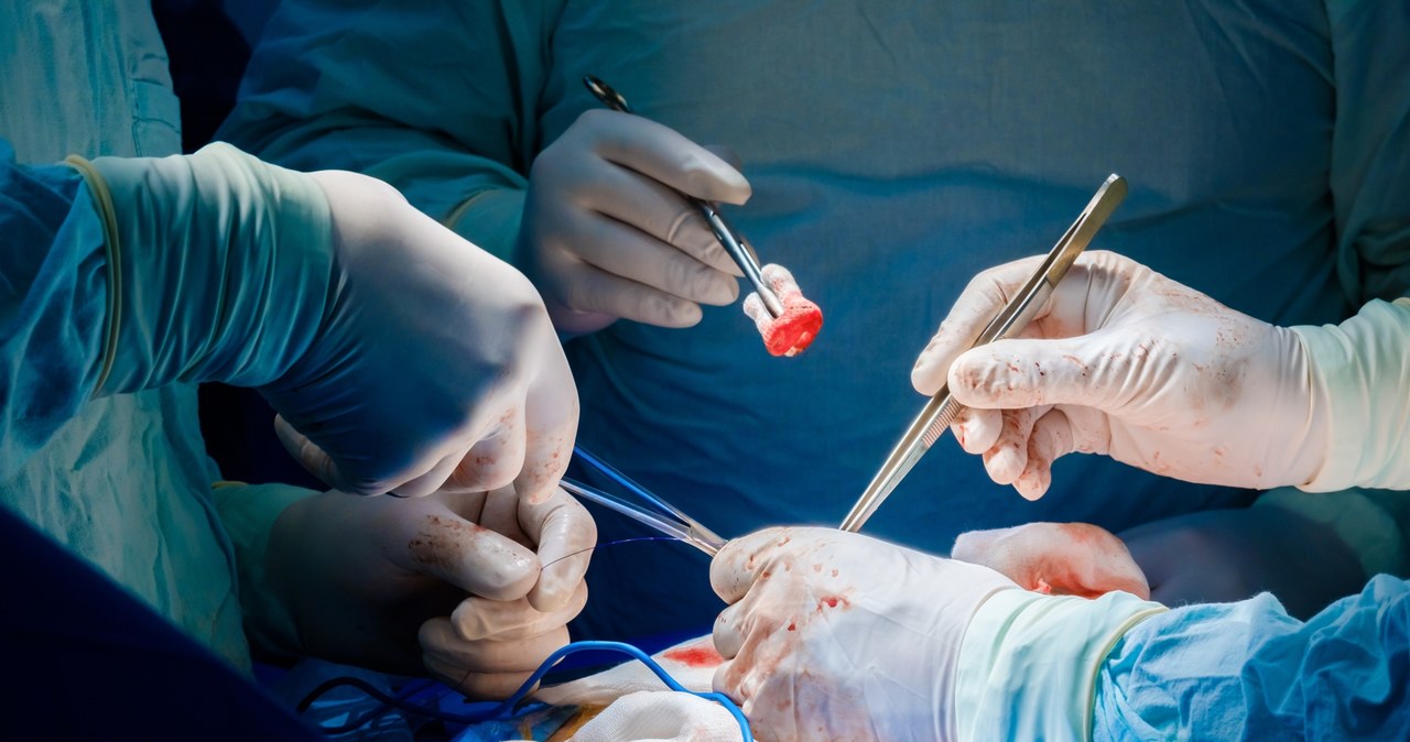 Operacje serca potrafią trwać nawet kilkanaście godzin i wymagają pracy wielu zespołów specjalistów /123RF/PICSEL