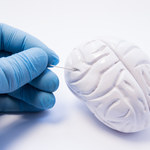 Oponiak mózgu - objawy i leczenie 