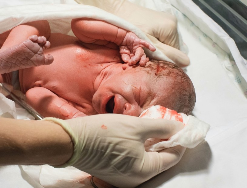 Opóźnione odpępnienie niesie za sobą wiele korzyści dla dziecka /123RF/PICSEL